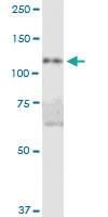 Anti-DIS3L Mouse Polyclonal Antibody