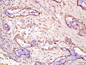 Anti-TM4SF+H319617:H3203143 Rabbit Polyclonal Antibody