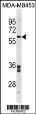 Anti-FMO5 Rabbit Polyclonal Antibody (AP (Alkaline Phosphatase))