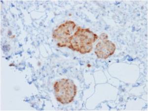 Immunohistochemical analysis of formalin-fixed, paraffin-embedded human pancreas using Anti-Chromogranin A Antibody [rCHGA/777]