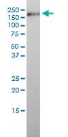 Anti-ICAM3 Mouse Monoclonal Antibody [clone: 2F8]