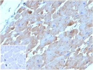 Immunohistochemical analysis of formalin-fixed, paraffin-embedded human heart tissue using Anti-BNP Antibody [NPPB/4493] Inset: PBS instead of the primary antibody Secondary antibody negative control