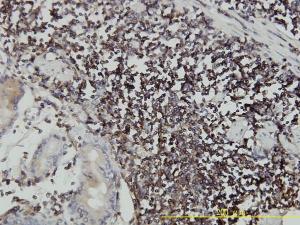 Anti-ICAM3 Mouse Monoclonal Antibody [clone: 2F8]