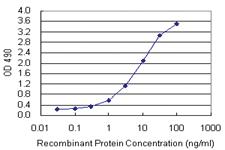 Anti-TWF1 Antibody Pair