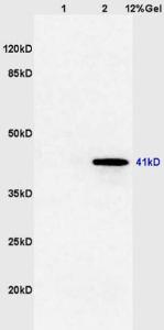 Anti-FOXE1 Rabbit Polyclonal Antibody