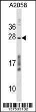 Anti-CCDC144NL Rabbit Polyclonal Antibody (PE (Phycoerythrin))