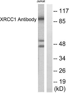 Western blot analysis of lysates from Jurkat cells using Anti-XRCC1 Antibody. The right hand lane represents a negative control, where the antibody is blocked by the immunising peptide.