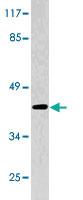 Anti-SERPINB2 Rabbit Polyclonal Antibody