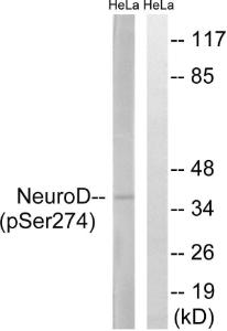 Western blot analysis of lysates from HeLa cells treated with UV 15' using Anti-Neuro D (phospho Ser274) Antibody. The right hand lane represents a negative control, where the antibody is blocked by the immunising peptide