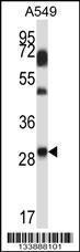 Anti-NNMT Rabbit Polyclonal Antibody (FITC (Fluorescein Isothiocyanate))