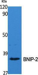 Western blot analysis of various cells using Anti-BNIP-2 Antibody