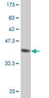 Anti-IL1RAPL1 Mouse Polyclonal Antibody