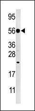 Anti-DUSP8 Rabbit Polyclonal Antibody (PE (Phycoerythrin))