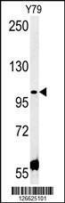 Anti-CCDC146 Rabbit Polyclonal Antibody (AP (Alkaline Phosphatase))