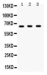 Anti-CHEK2 Rabbit Polyclonal Antibody