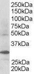 Anti-FBXW2 Antibody (A83956) staining (03 µg/ml) of Human Kidney lysate (RIPA buffer, 30 µg total protein per lane) Primary incubated for 1 hour Detected by western blot using chemiluminescence