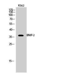 Western blot analysis of K562 cells using Anti-BNIP-2 Antibody