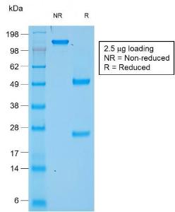 SDS-PAGE analysis of Anti-Chromogranin A Antibody [rCHGA/777] under non-reduced and reduced conditions; showing intact IgG and intact heavy and light chains, respectively SDS-PAGE analysis confirms the integrity and purity of the antibody