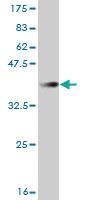 Anti-FBXL3 Mouse Monoclonal Antibody [clone: 3C4]