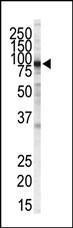 Anti-IKBKB Mouse Monoclonal Antibody (APC (Allophycocyanin)) [clone: 62AT216]