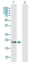 Anti-ICT1 Mouse Polyclonal Antibody