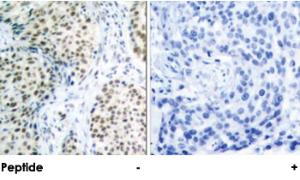 Anti-ATM Rabbit Polyclonal Antibody