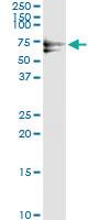 Anti-PLK1 Antibody Pair