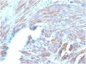 Immunohistochemical analysis of formalin-fixed, paraffin-embedded human uterus tissue using Anti-BNP Antibody [NPPB/4493]