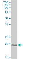 Anti-ICT1 Mouse Polyclonal Antibody