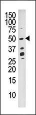 Anti-DUSP10 Rabbit Polyclonal Antibody (APC (Allophycocyanin))