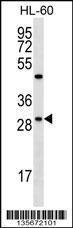 Anti-FMR1NB Rabbit Polyclonal Antibody (AP (Alkaline Phosphatase))