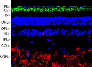 Pig retinal section stained with Anti-Rhodopsin Antibody (green), Anti-NF-M Antibody (A85323/red) and DNA (blue)