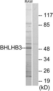 Antibody anti-BHLHB3 100 µg