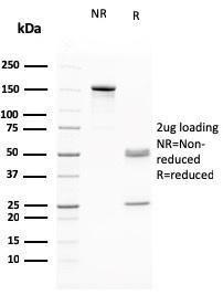 SDS-PAGE analysis of Anti-RAD51 Antibody [RAD51/2765] under non-reduced and reduced conditions; showing intact IgG and intact heavy and light chains, respectively. SDS-PAGE analysis confirms the integrity and purity of the Antibody