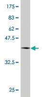 Anti-HNRNPM Mouse Monoclonal Antibody [clone: 2B6]