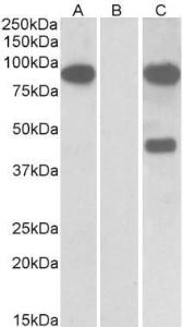 HEK293 lysate (10ug protein in RIPA buffer) overexpressing Human Numbl with C-terminal MYC tag probed with Anti-NUMBL Antibody (A83961) (1µg/ml) in Lane A and probed with anti-MYC Tag (1/1000) in lane C