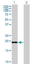 Anti-ICT1 Rabbit Polyclonal Antibody