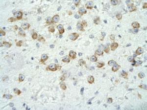 Anti-MED17 Rabbit Polyclonal Antibody