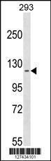 Anti-CCDC147 Rabbit Polyclonal Antibody (AP (Alkaline Phosphatase))