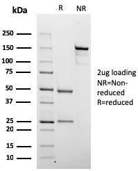 SDS-PAGE analysis of Anti-Chromogranin A Antibody [rCHGA/798] under non-reduced and reduced conditions; showing intact IgG and intact heavy and light chains, respectively. SDS-PAGE analysis confirms the integrity and purity of the antibody.