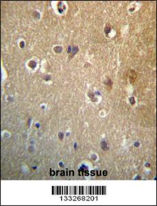 Anti-HDAC3 Rabbit Polyclonal Antibody (FITC (Fluorescein Isothiocyanate))