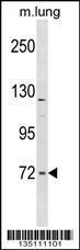 Anti-FNBP1L Rabbit Polyclonal Antibody (AP (Alkaline Phosphatase))