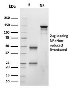 SDS-PAGE analysis of Anti-BNP Antibody [NPPB/4493] under non-reduced and reduced conditions; showing intact IgG and intact heavy and light chains, respectively SDS-PAGE analysis confirms the integrity and purity of the antibody