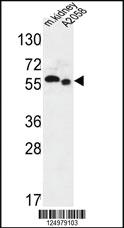 Anti-S47A2 Rabbit Polyclonal Antibody