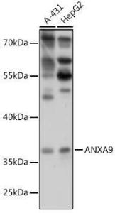 Western blot analysis of extracts of various cell lines, using Anti-Annexin-9/ANXA9 Antibody (A307887) at 1:1,000 dilution The secondary antibody was Goat Anti-Rabbit IgG H&L Antibody (HRP) at 1:10,000 dilution Lysates/proteins were present at 25 µg per lane