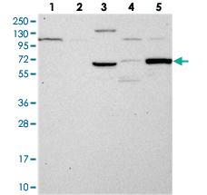 Anti-TCP11L2 Rabbit Polyclonal Antibody