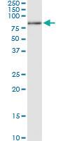 Anti-PLK1 Polyclonal Antibody Pair