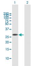 Anti-FAM60A Mouse Polyclonal Antibody