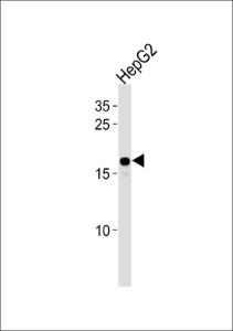 Anti-HMGA2 Rabbit Polyclonal Antibody (APC (Allophycocyanin))