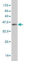 Anti-HUNK Mouse Monoclonal Antibody [clone: 2E3]